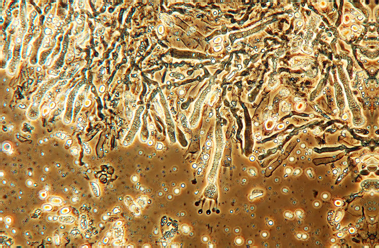 Plasmodio vs Phanerochaete?-foto3517(Hyphoderma roseocremeum